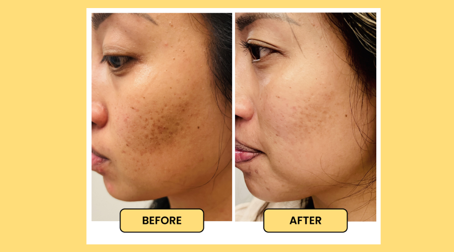 Dark Circle Eye Cream With Peptide Complex